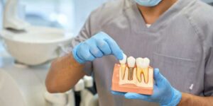 dentista para implantes dentales en Reino Unido