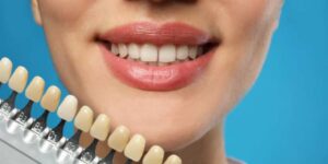 limpieza dental