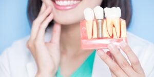 implantes dentales baratos