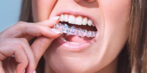 Mujer que sostiene un alineador transparente frente a sus dientes